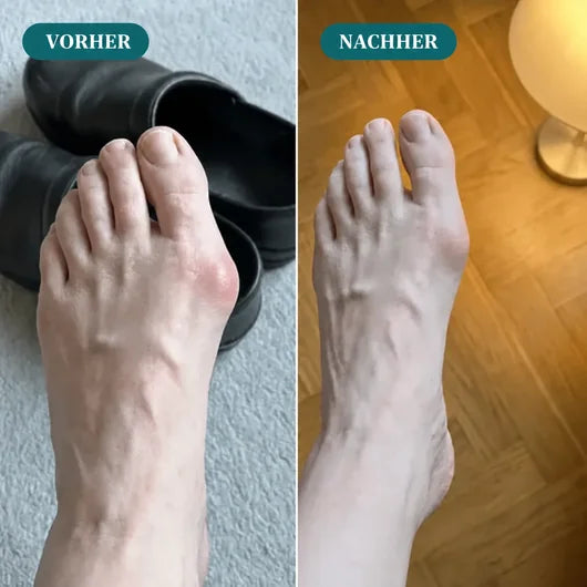 EMS Hallux-Korrektor